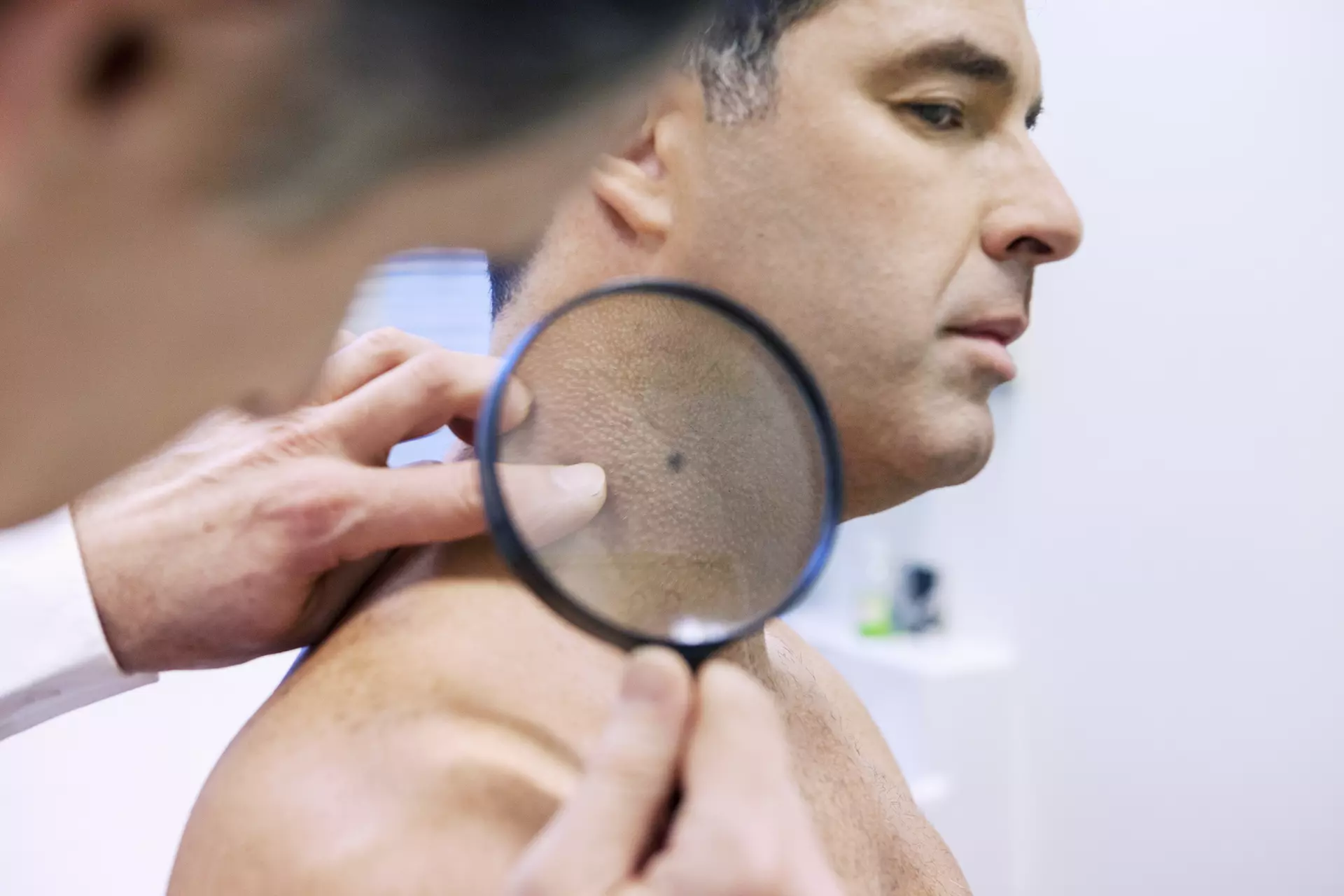 Mohs Surgery procedure